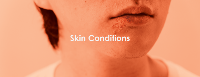 skin conditions treatment urgent care