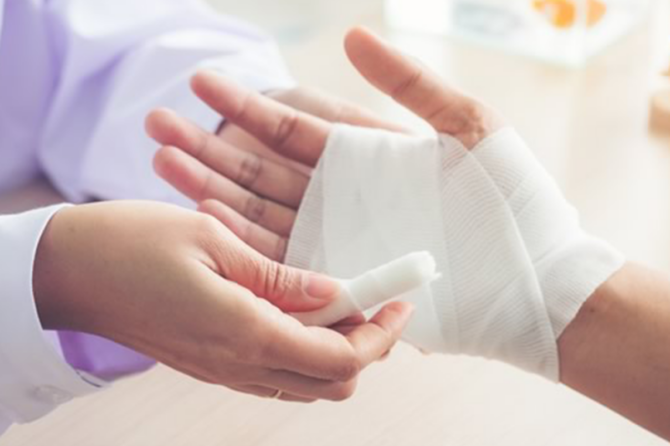 4 Different Types of Burns and Treatment